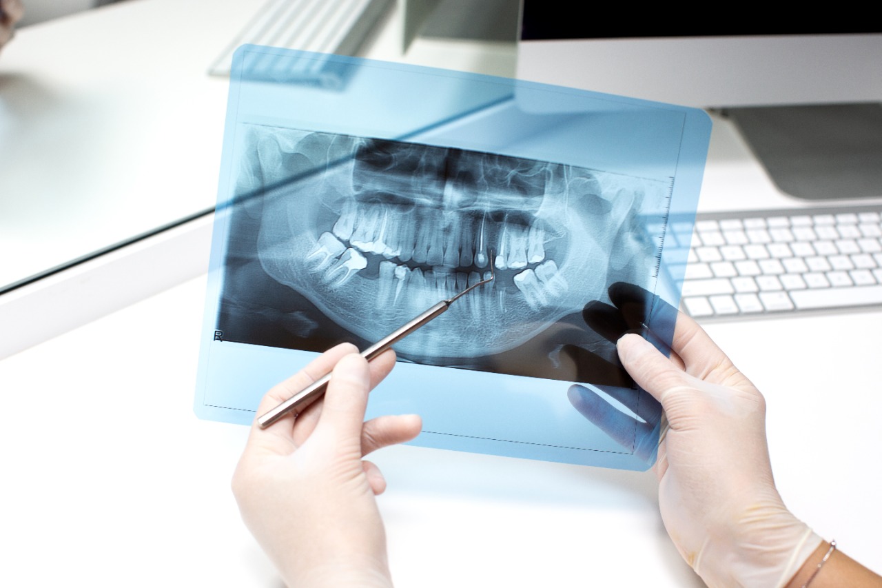 radiografias-dentales-en-medellin